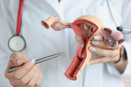 The doctor's hands hold a sectional model of the female reproductive organs used in training in gynecology and obstetrics